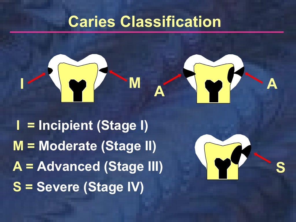 radiographiccariesdiagnosis