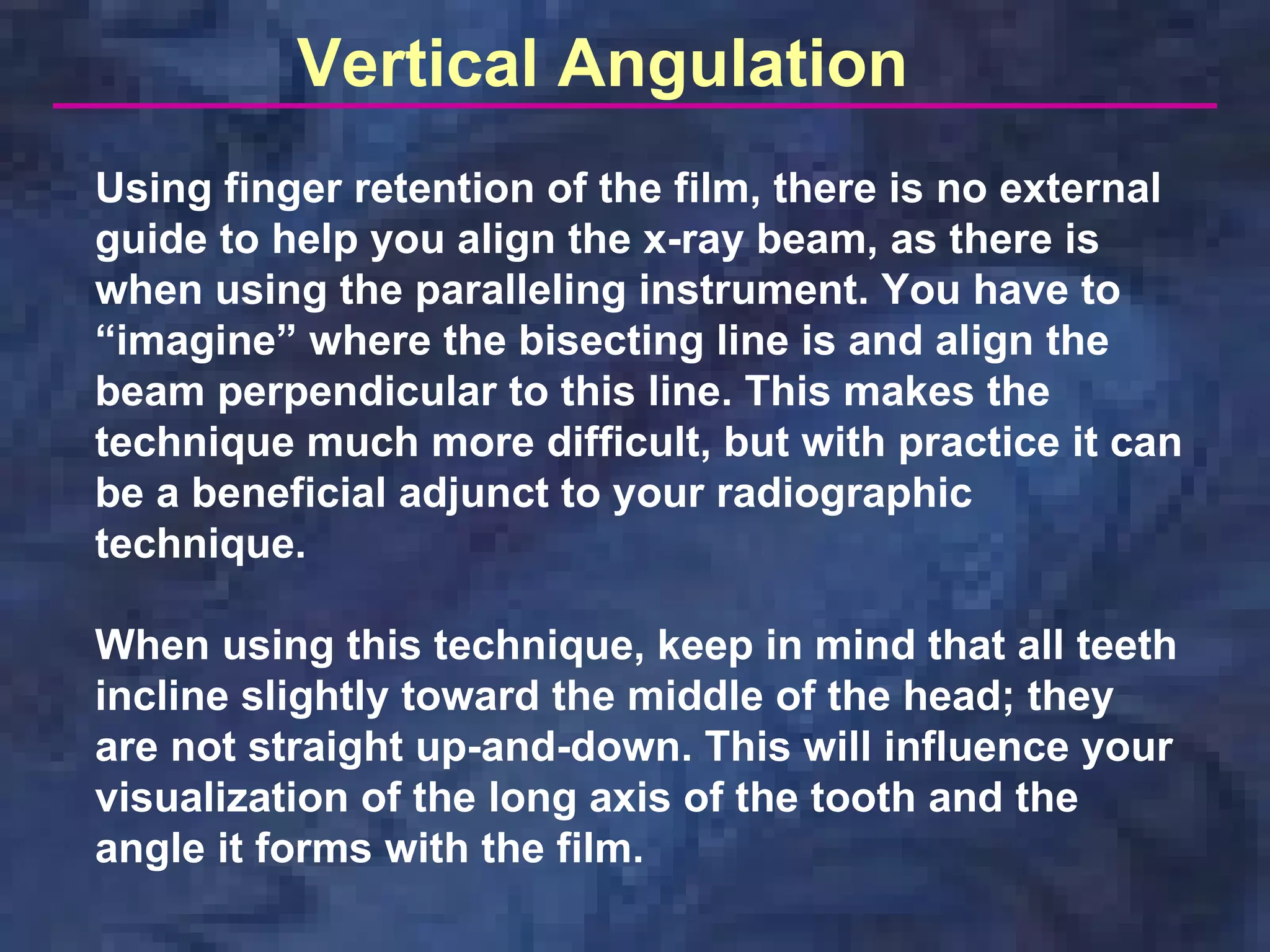 radio-graphic-techniques-bisecting-and-occlusal | PDF
