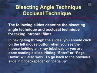 0
    Bisecting Angle Technique
       Occlusal Technique

The following slides describe the bisecting
angle technique and occlusal technique
for taking intraoral films.
In navigating through the slides, you should click
on the left mouse button when you see the
mouse holding an x-ray tubehead or you are
done reading a slide. Hitting “Enter” or “Page
Down” will also work. To go back to the previous
slide, hit “backspace” or “page up”.
 