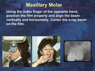 Tooth Bisection radio-graphic-techniques-bisecting-and-occlusal | PDF