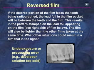 Inverted Radiographic Film radio-graphic-techniques-bisecting-and-occlusal | PDF