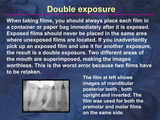 Inverted Radiographic Film radio-graphic-techniques-bisecting-and-occlusal | PDF