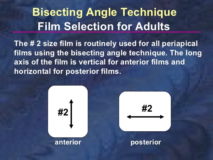 radiographictechniquesbisectingandocclusal