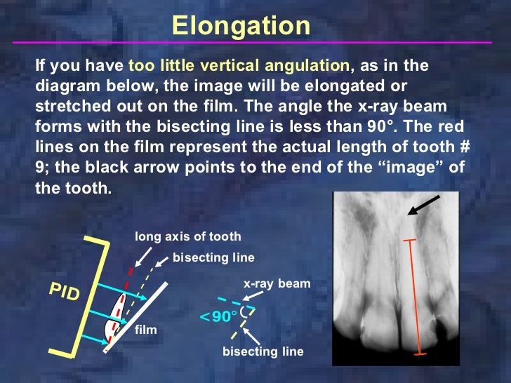 radiographictechniquesbisectingandocclusal