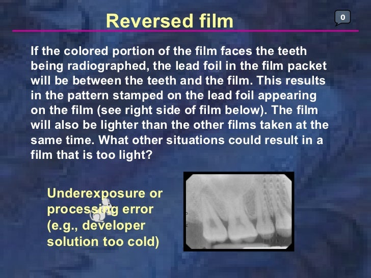 radiographictechniquesbisectingandocclusal
