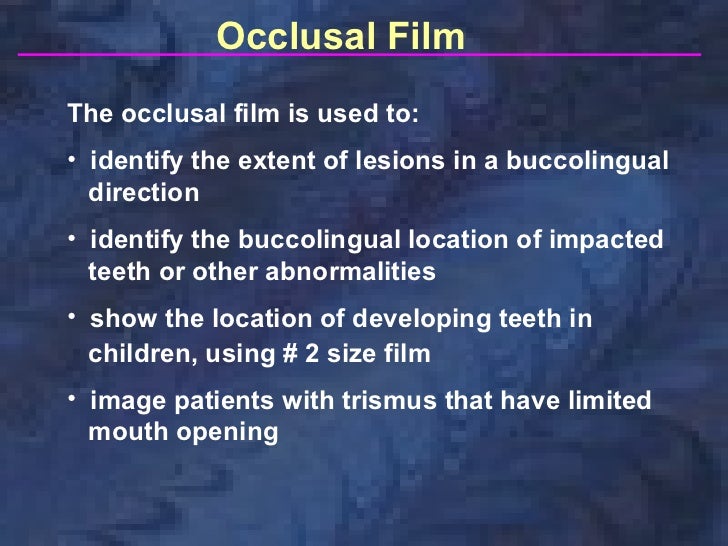 radiographictechniquesbisectingandocclusal