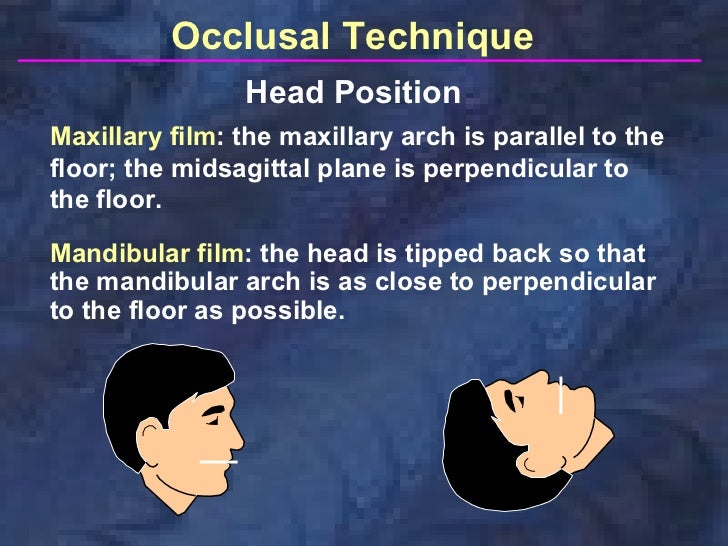 radiographictechniquesbisectingandocclusal