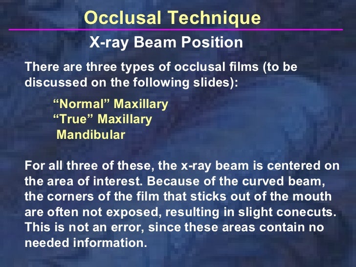 radiographictechniquesbisectingandocclusal