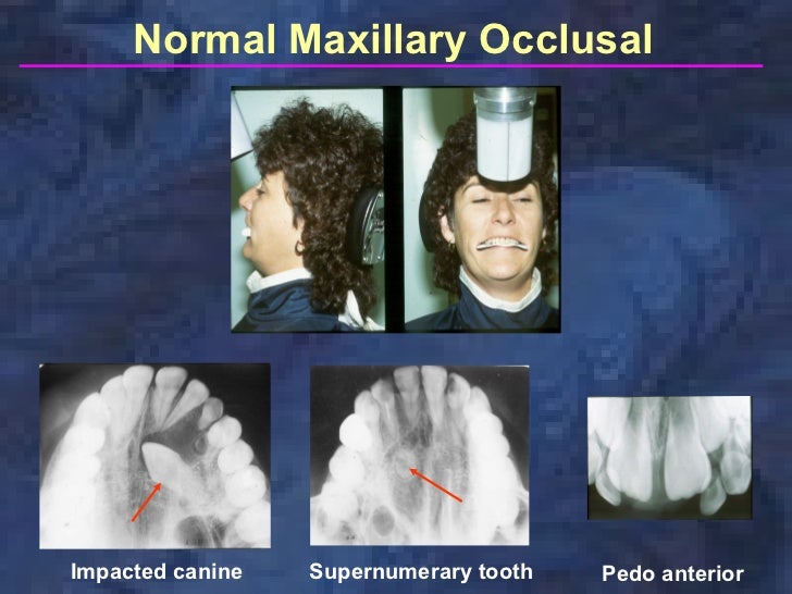radiographictechniquesbisectingandocclusal