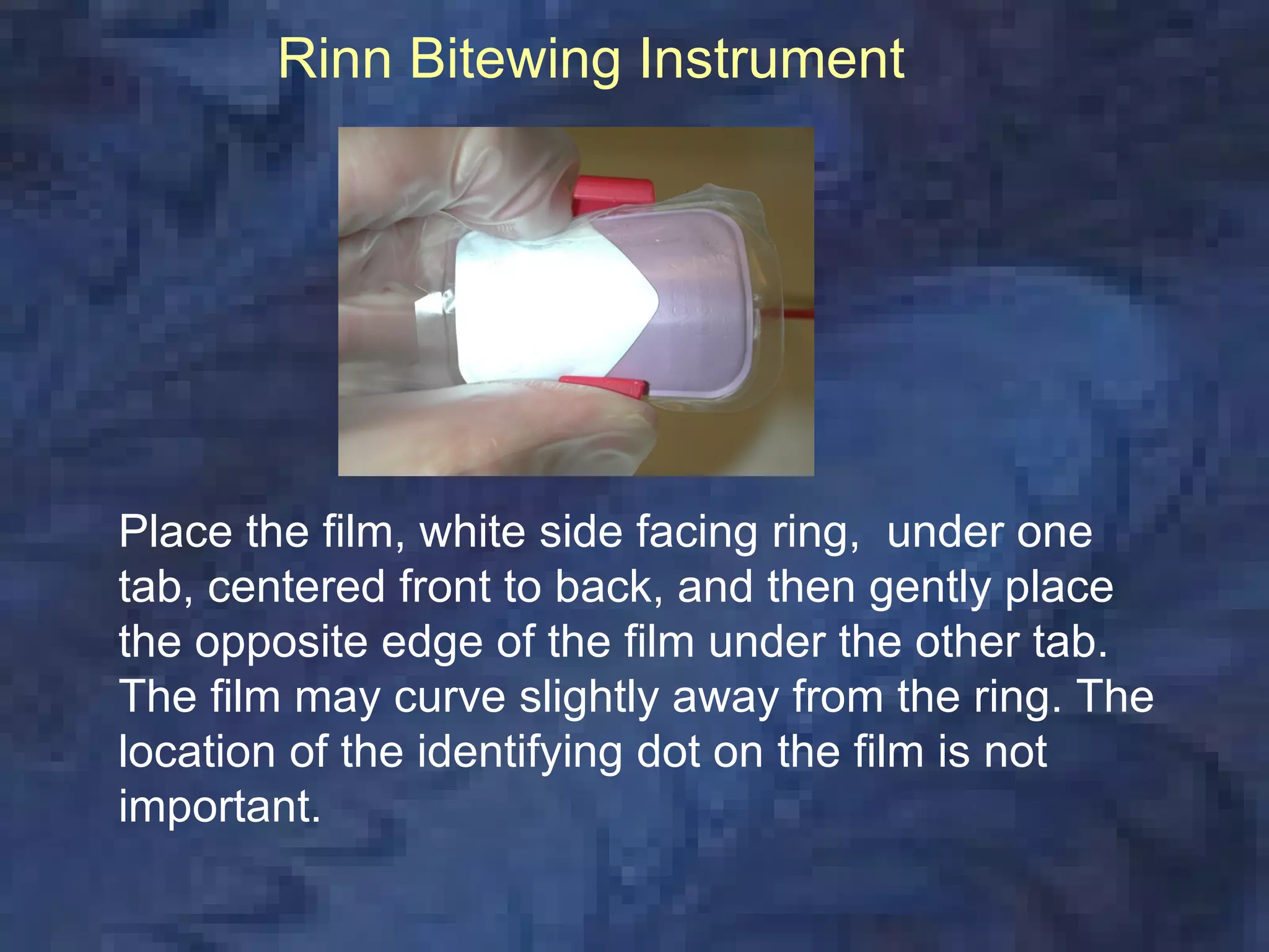 Rinn Bitewing Instrument




Place the film, white side facing ring, under one
tab, centered front to back, and then gently place
the opposite edge of the film under the other tab.
The film may curve slightly away from the ring. The
location of the identifying dot on the film is not
important.
 