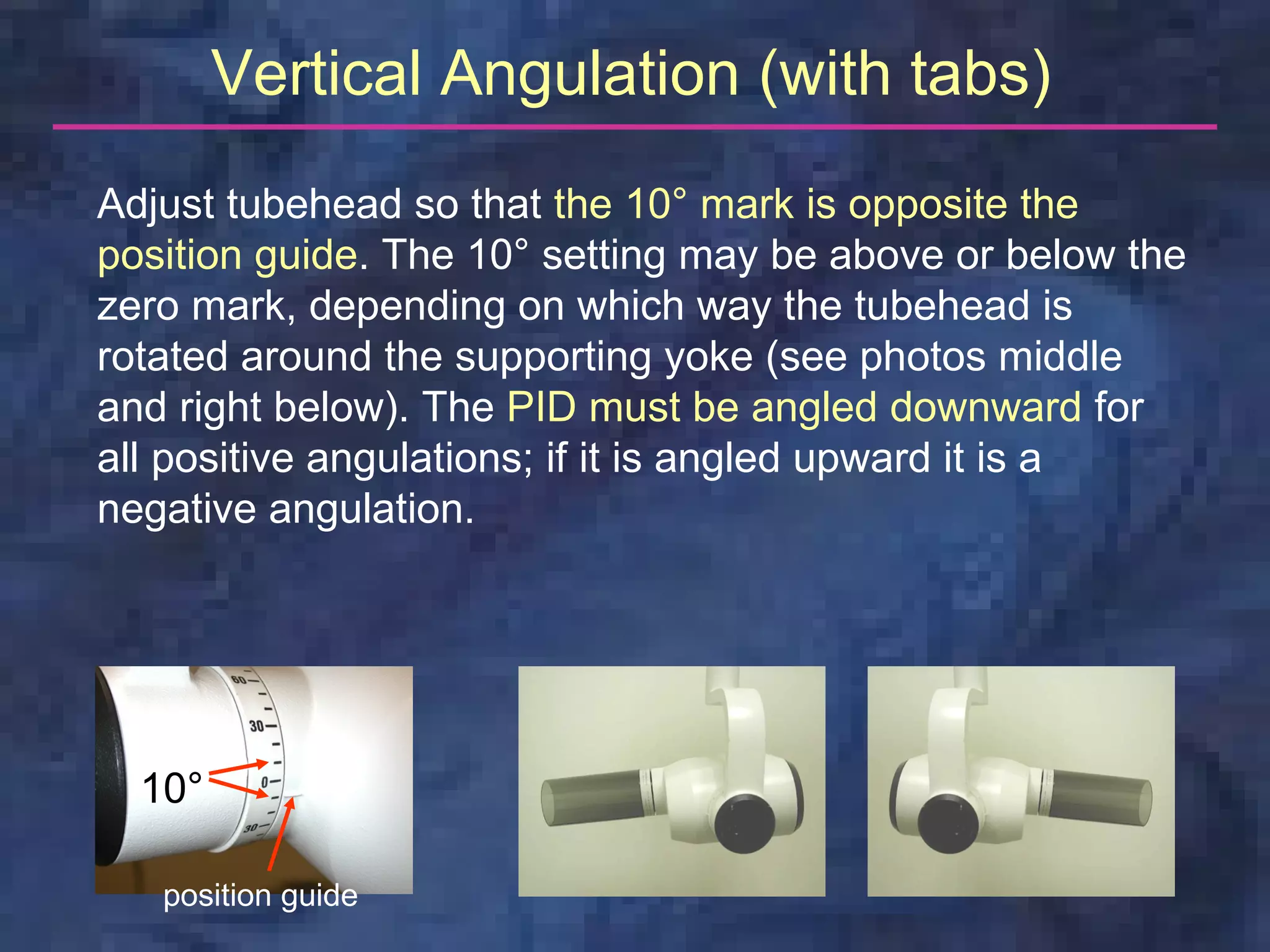 Vertical Angulation (with tabs)
Adjust tubehead so that the 10° mark is opposite the
position guide. The 10° setting may be above or below the
zero mark, depending on which way the tubehead is
rotated around the supporting yoke (see photos middle
and right below). The PID must be angled downward for
all positive angulations; if it is angled upward it is a
negative angulation.




  10°

   position guide
 