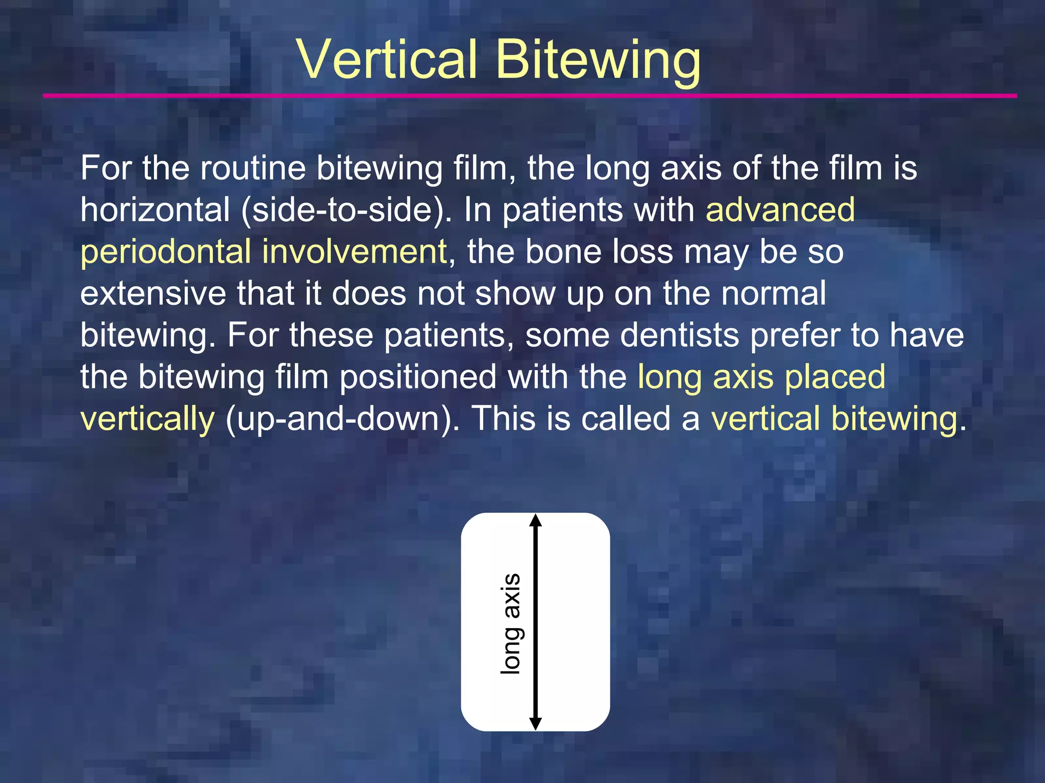 Vertical Bitewing
For the routine bitewing film, the long axis of the film is
horizontal (side-to-side). In patients with advanced
periodontal involvement, the bone loss may be so
extensive that it does not show up on the normal
bitewing. For these patients, some dentists prefer to have
the bitewing film positioned with the long axis placed
vertically (up-and-down). This is called a vertical bitewing.

                            long axis
 