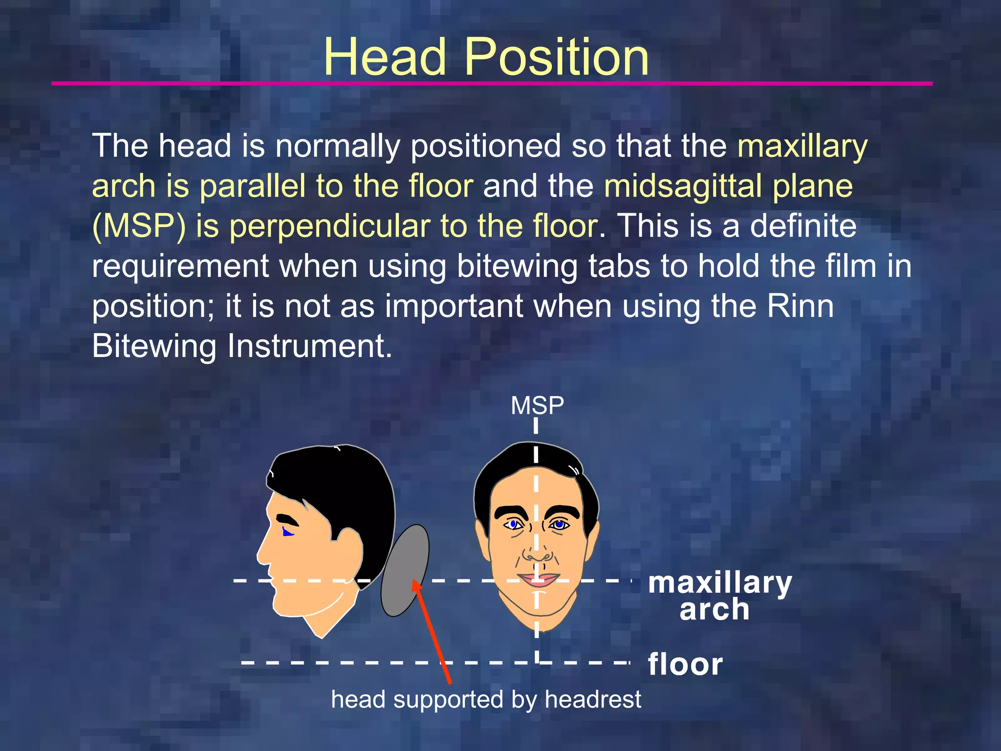 Head Position
The head is normally positioned so that the maxillary
arch is parallel to the floor and the midsagittal plane
(MSP) is perpendicular to the floor. This is a definite
requirement when using bitewing tabs to hold the film in
position; it is not as important when using the Rinn
Bitewing Instrument.
                               MSP




                head supported by headrest
 