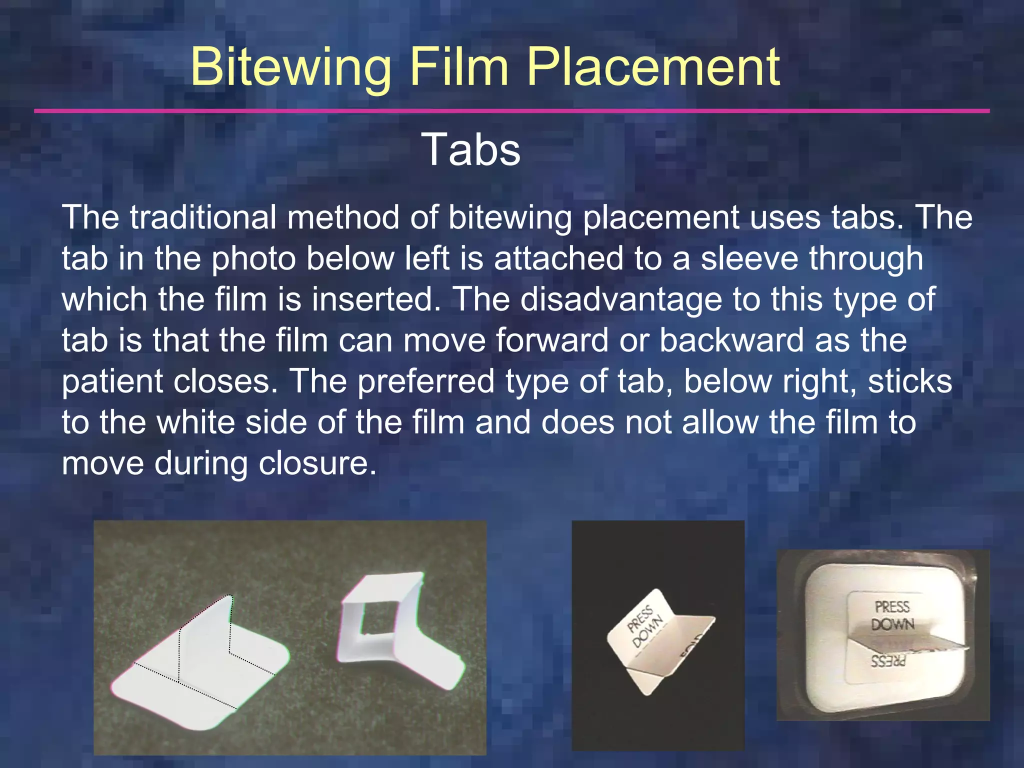 Bitewing Film Placement
                        Tabs
The traditional method of bitewing placement uses tabs. The
tab in the photo below left is attached to a sleeve through
which the film is inserted. The disadvantage to this type of
tab is that the film can move forward or backward as the
patient closes. The preferred type of tab, below right, sticks
to the white side of the film and does not allow the film to
move during closure.
 