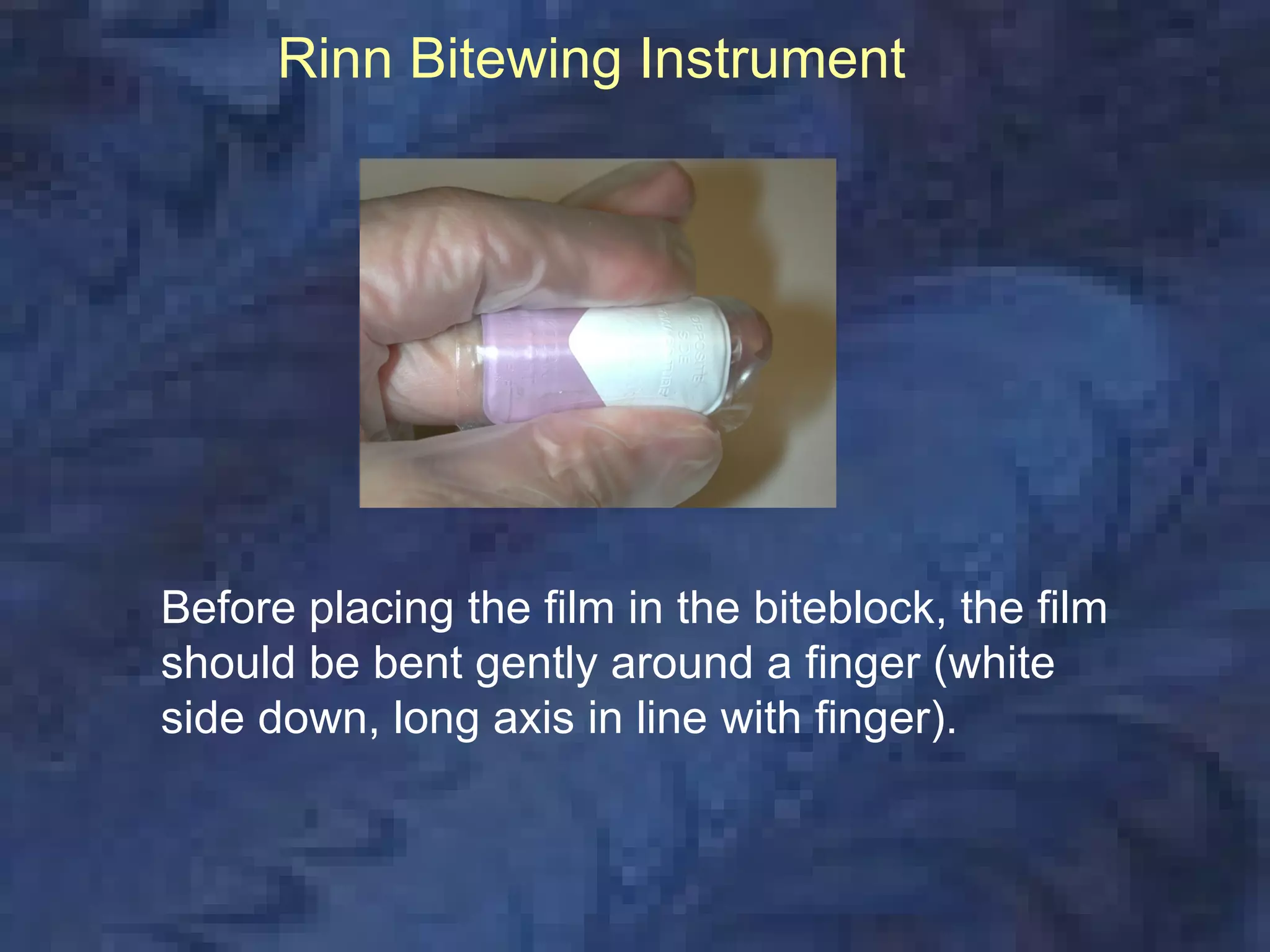 Rinn Bitewing Instrument




Before placing the film in the biteblock, the film
should be bent gently around a finger (white
side down, long axis in line with finger).
 