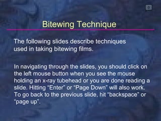 0




           Bitewing Technique
The following slides describe techniques
used in taking bitewing films.

In navigating through the slides, you should click on
the left mouse button when you see the mouse
holding an x-ray tubehead or you are done reading a
slide. Hitting “Enter” or “Page Down” will also work.
To go back to the previous slide, hit “backspace” or
“page up”.
 