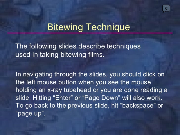 radiologybitewingtechnique