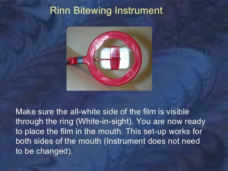How To Set Up Xray Ring Dental How To Set Up Xray Ring Dental