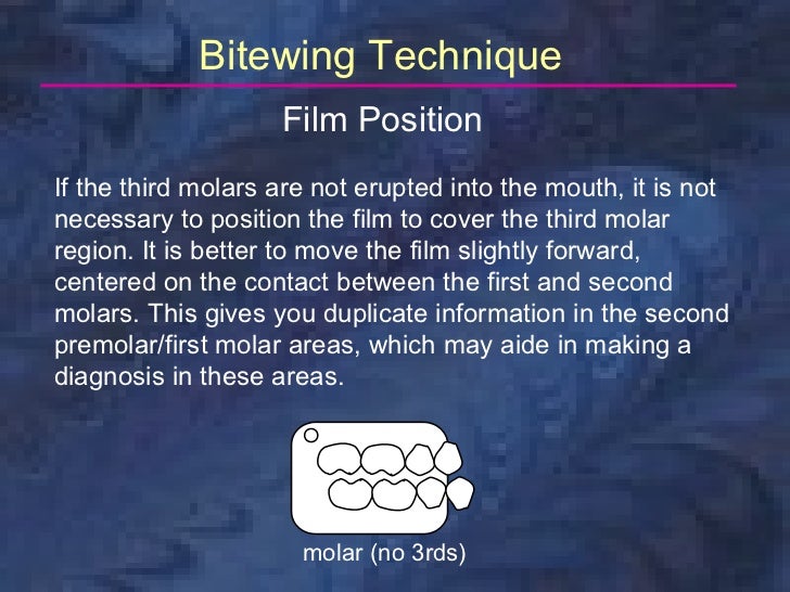 radiologybitewingtechnique