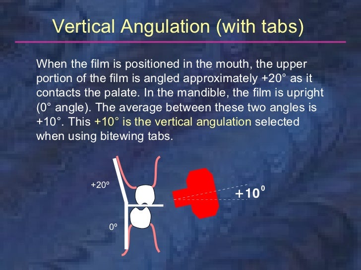 radiologybitewingtechnique