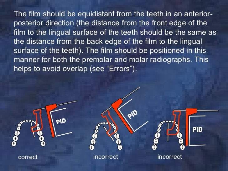 radiologybitewingtechnique