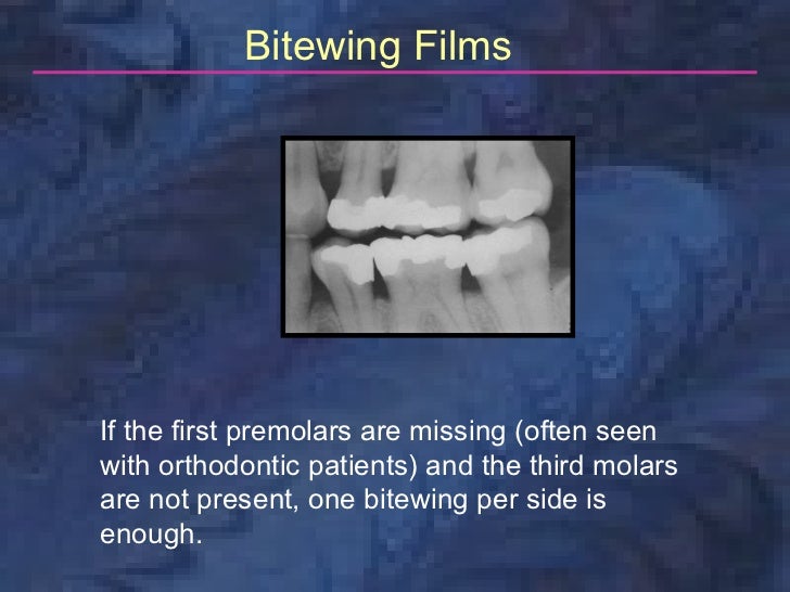 radiologybitewingtechnique