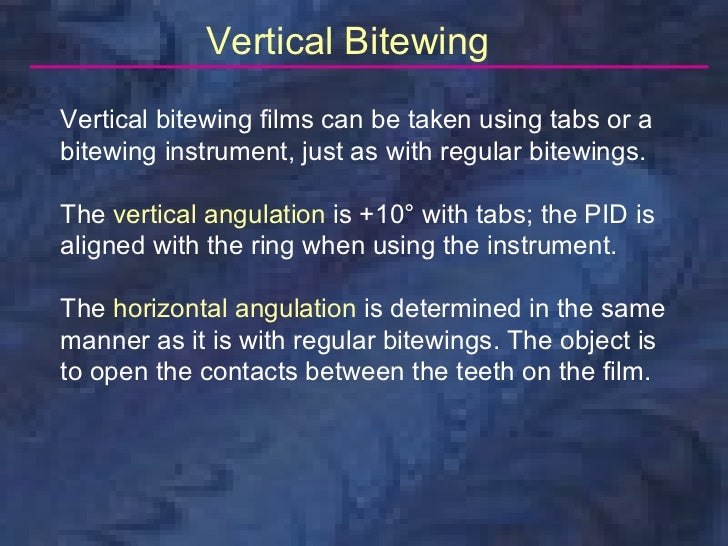 radiologybitewingtechnique