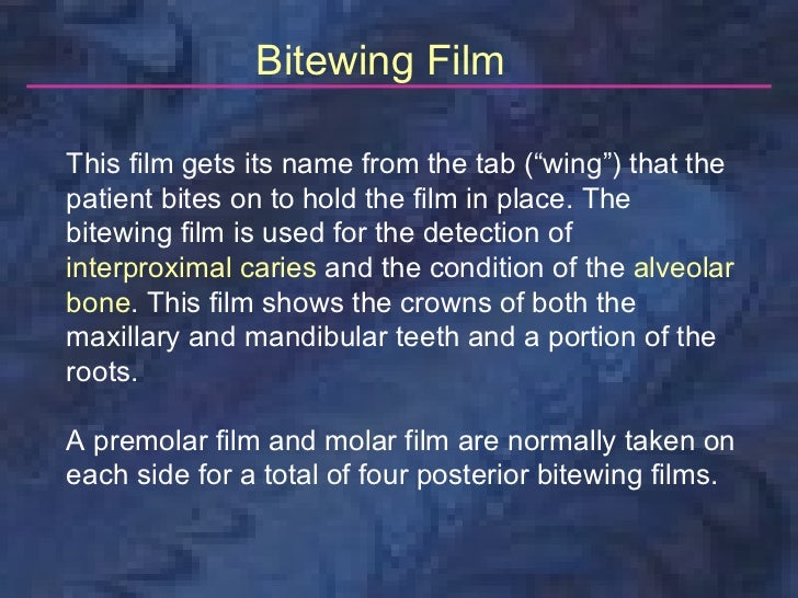 radiologybitewingtechnique
