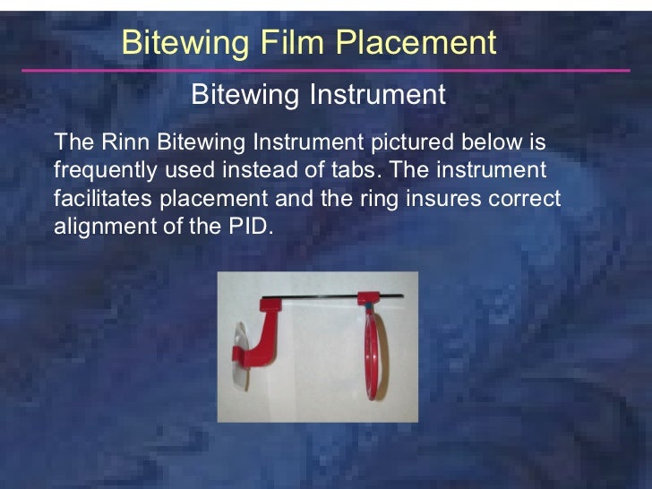 radiologybitewingtechnique