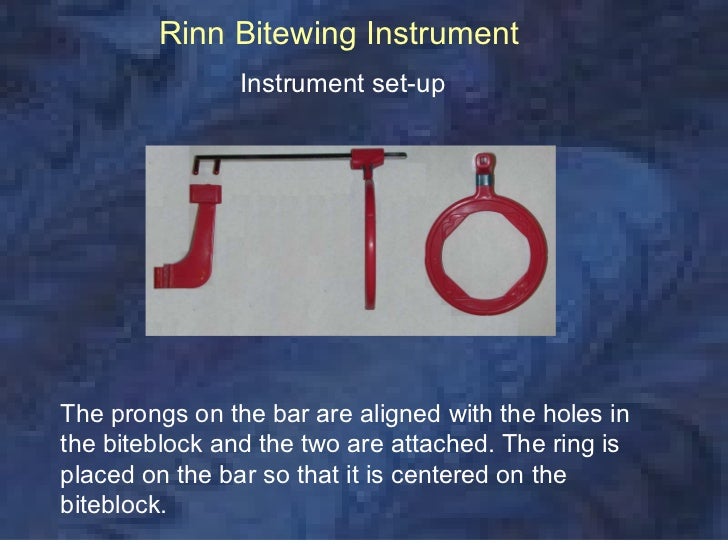 radiologybitewingtechnique