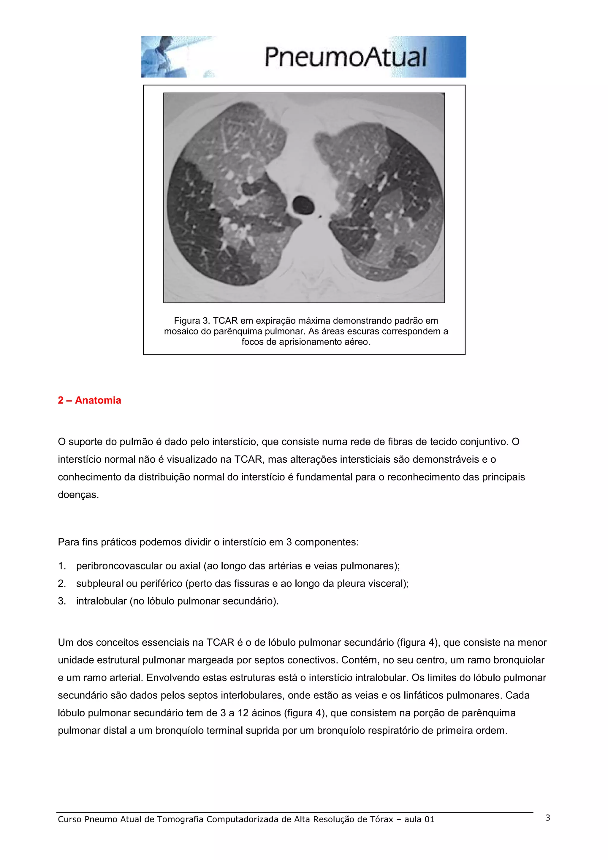 aula-1-tomografia-de-t-rax-de-alta-resolu-o-pdf