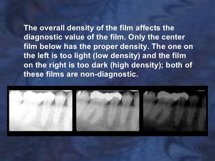 radiologyimagecharacteristics