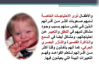 والأطفاااال ذوى الاحتياجاااات الخاصاااة 
لاااديهم صاااعوبات أكثااار مااان أقااارانهم 
الااذين فااي نفااس ساانهم بساابب وجااود 
مشاكل لديهم في النطق والتعبيار عان 
احتياجاتهم، ومشاكل أيضا في السمع 
والااذاكرة القصاايرة والتاار ر البصااري 
الحركي، كما أنهم يأخاذون وقتاا أكثار 
ماااان أقاااارانهم لااااتعلم القواعااااد وفهاااام 
التعبيرات البيئة التي يعيشون فيها. 
 