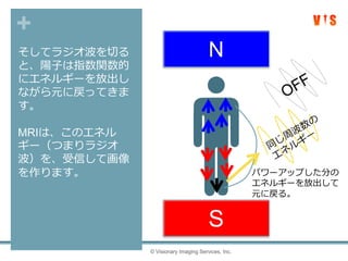+
そしてラジオ波を切る
と、陽子は指数関数的
にエネルギーを放出し
ながら元に戻ってきま
す。
MRIは、このエネル
ギー（つまりラジオ
波）を、受信して画像
を作ります。
© Visionary Imaging Services, Inc.
N
S
パワーアップした分の
エネルギーを放出して
元に戻る。
 