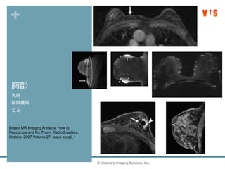+
胸部
乳房
縦隔腫瘍
など
© Visionary Imaging Services, Inc.
Breast MR Imaging Artifacts: How to
Recognize and Fix Them. RadioGraphics,
October 2007.Volume 27, Issue suppl_1
 