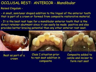 3_2019_10_12!08_49_31_PM partial denture .ppt