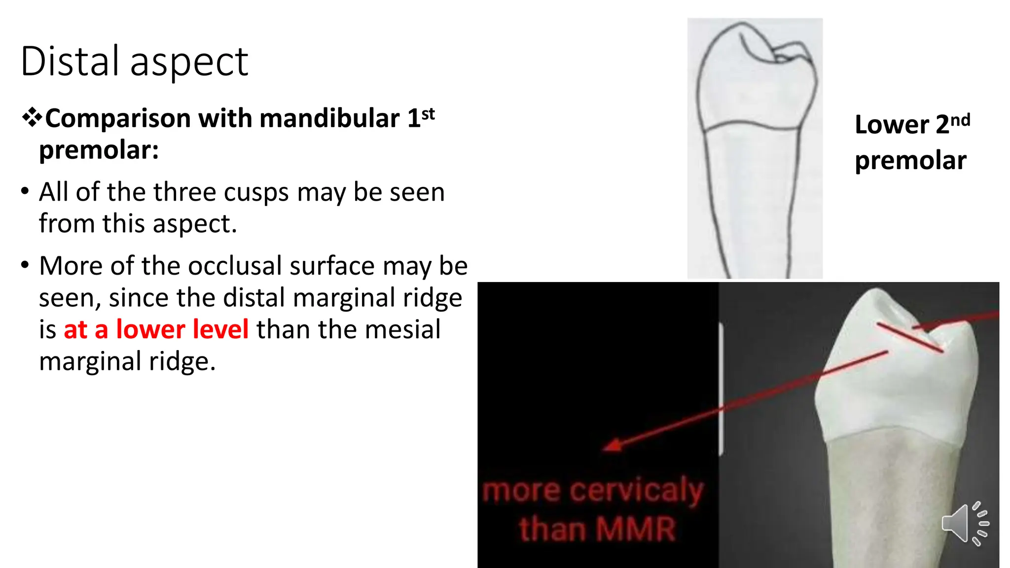 mandibular second premolar-dentistry undergraduate | PPTX