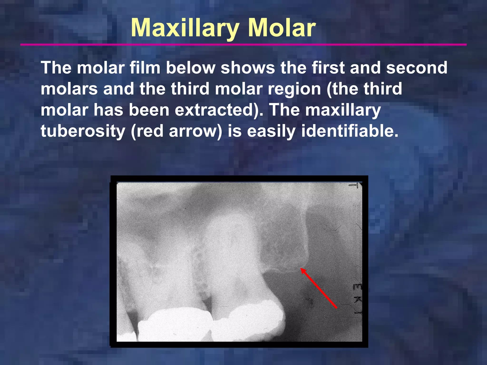 radiology-paralleling-technique | PDF