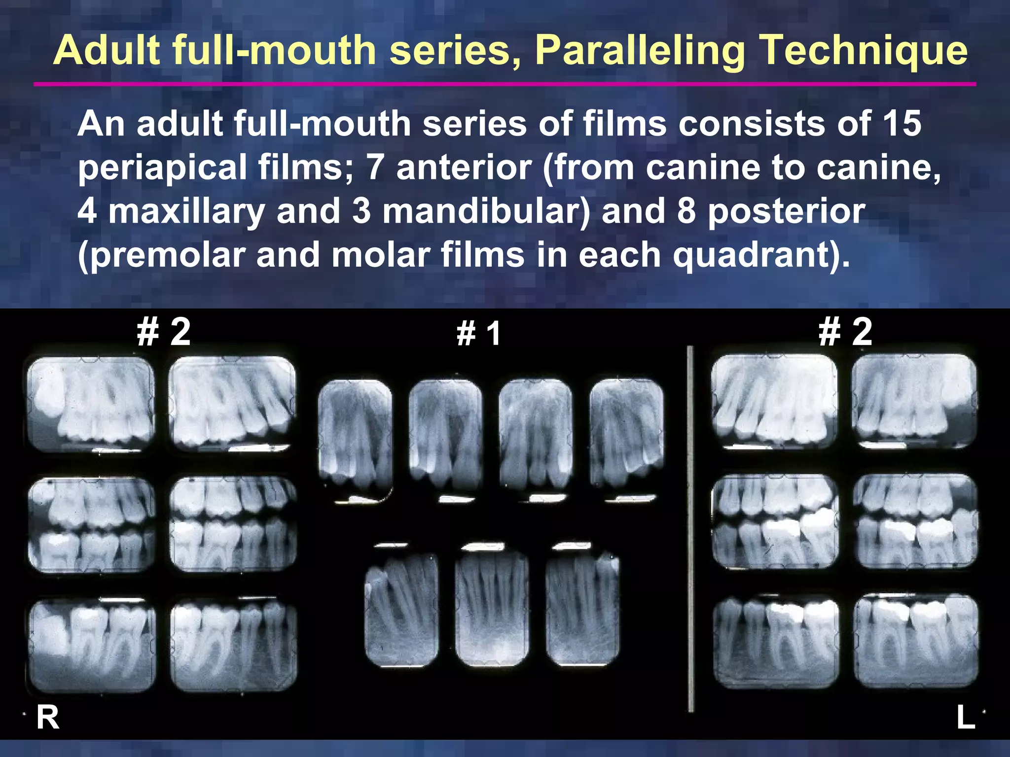 radiology-paralleling-technique | PDF