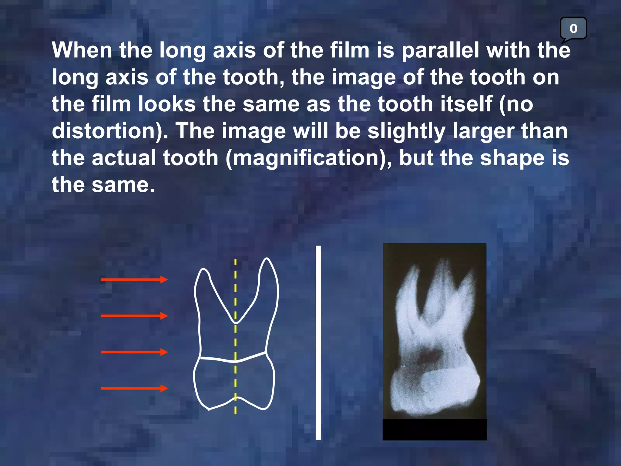 radiology-paralleling-technique | PDF