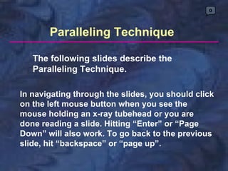 0




       Paralleling Technique

   The following slides describe the
   Paralleling Technique.

In navigating through the slides, you should click
on the left mouse button when you see the
mouse holding an x-ray tubehead or you are
done reading a slide. Hitting “Enter” or “Page
Down” will also work. To go back to the previous
slide, hit “backspace” or “page up”.
 