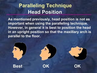Paralleling Technique
         Head Position
As mentioned previously, head position is not as
important when using the paralleling technique.
However, in general it is best to position the head
in an upright position so that the maxillary arch is
parallel to the floor.




   Best              OK                  OK
 