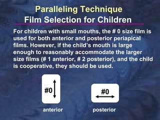 Paralleling Technique
    Film Selection for Children
For children with small mouths, the # 0 size film is
used for both anterior and posterior periapical
films. However, if the child’s mouth is large
enough to reasonably accommodate the larger
size films (# 1 anterior, # 2 posterior), and the child
is cooperative, they should be used.



            #0                    #0

           anterior            posterior
 