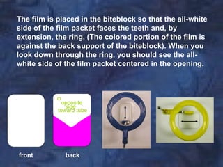 The film is placed in the biteblock so that the all-white
side of the film packet faces the teeth and, by
extension, the ring. (The colored portion of the film is
against the back support of the biteblock). When you
look down through the ring, you should see the all-
white side of the film packet centered in the opening.




              opposite
               side
            toward tube




front         back
 