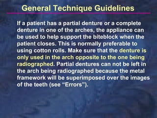 General Technique Guidelines
If a patient has a partial denture or a complete
denture in one of the arches, the appliance can
be used to help support the biteblock when the
patient closes. This is normally preferable to
using cotton rolls. Make sure that the denture is
only used in the arch opposite to the one being
radiographed. Partial dentures can not be left in
the arch being radiographed because the metal
framework will be superimposed over the images
of the teeth (see “Errors”).
 