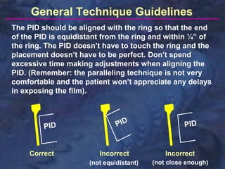 General Technique Guidelines
The PID should be aligned with the ring so that the end
of the PID is equidistant from the ring and within ¼” of
the ring. The PID doesn’t have to touch the ring and the
placement doesn’t have to be perfect. Don’t spend
excessive time making adjustments when aligning the
PID. (Remember: the paralleling technique is not very
comfortable and the patient won’t appreciate any delays
in exposing the film).



         PID                  PID                  PID


     Correct            Incorrect            Incorrect
                     (not equidistant)   (not close enough)
 