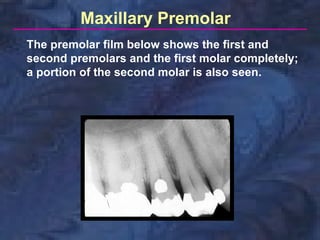 Maxillary Premolar
The premolar film below shows the first and
second premolars and the first molar completely;
a portion of the second molar is also seen.
 