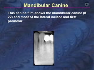 Mandibular Canine                        0




This canine film shows the mandibular canine (#
22) and most of the lateral incisor and first
premolar.
 