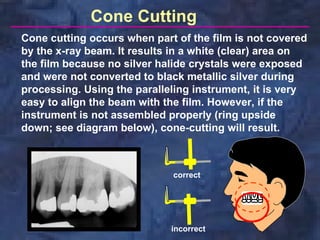 Cone Cutting
Cone cutting occurs when part of the film is not covered
by the x-ray beam. It results in a white (clear) area on
the film because no silver halide crystals were exposed
and were not converted to black metallic silver during
processing. Using the paralleling instrument, it is very
easy to align the beam with the film. However, if the
instrument is not assembled properly (ring upside
down; see diagram below), cone-cutting will result.



                             correct




                             incorrect
 