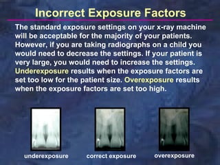 Incorrect Exposure Factors
The standard exposure settings on your x-ray machine
will be acceptable for the majority of your patients.
However, if you are taking radiographs on a child you
would need to decrease the settings. If your patient is
very large, you would need to increase the settings.
Underexposure results when the exposure factors are
set too low for the patient size. Overexposure results
when the exposure factors are set too high.




  underexposure     correct exposure    overexposure
 